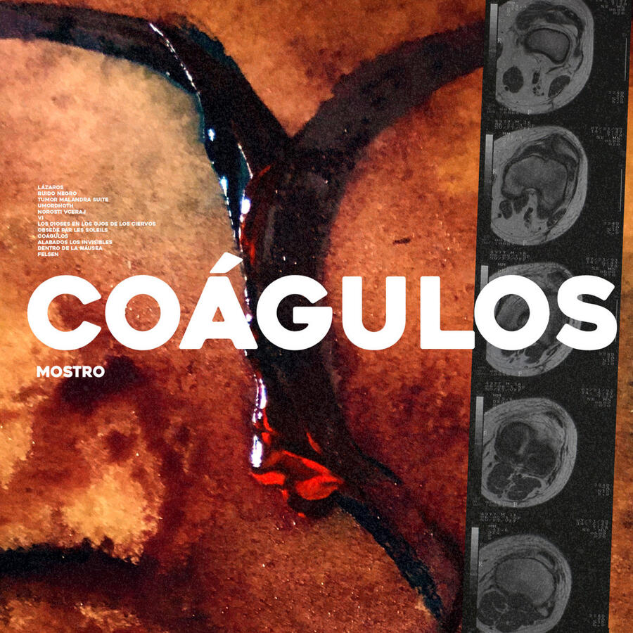 MOSTRO – COÁGULOS MOSTRO – COÁGULOS